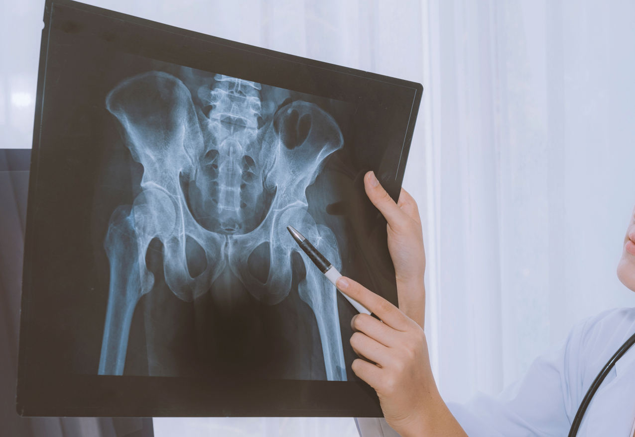 Radiographie d'un bassin d'un patient